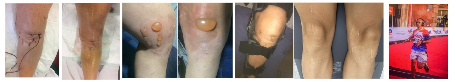 Imágenes del esfuerzo y la superación